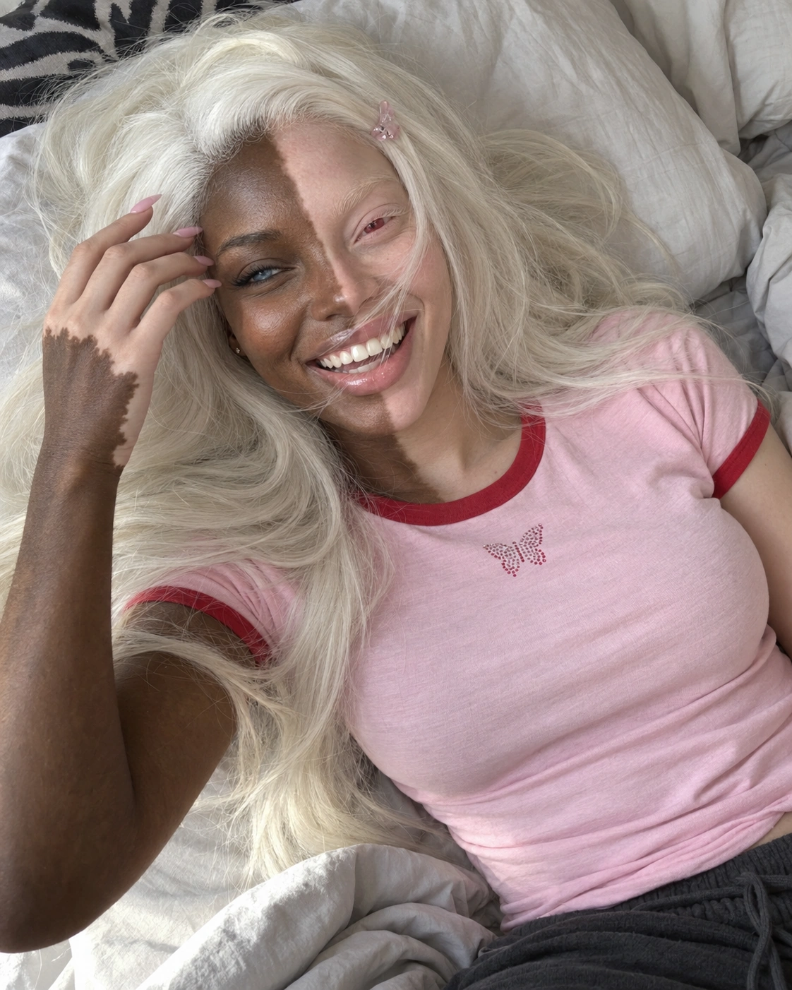 Eva smiling warmly with platinum hair, a blue eye on the dark half of her face and a pink eye on the pale half.